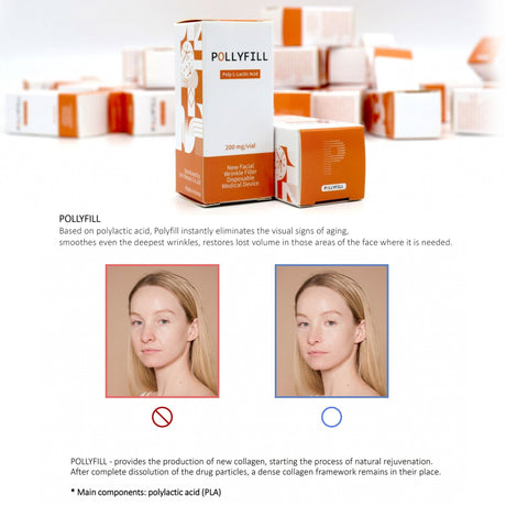 Pollyfill PLA - Filler Lux™ - Mesotherapy - Let It beauty Co., Ltd.